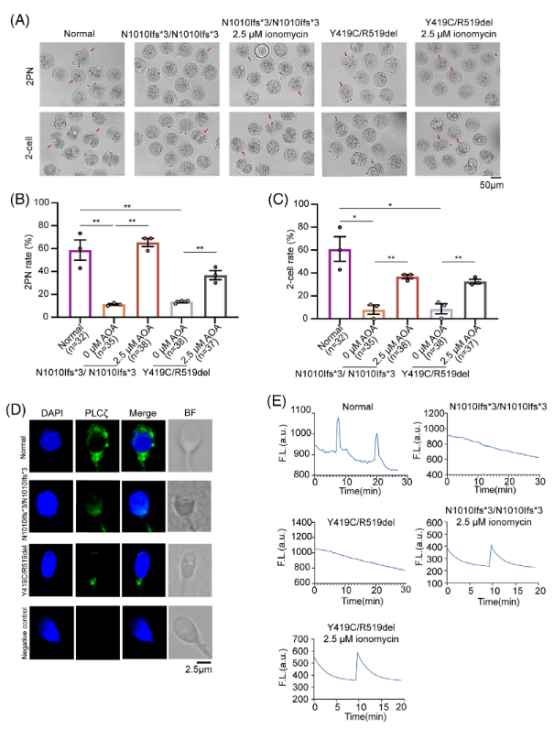 MedComm（IF=10.7）：全球首例TDRD6基因变异男性不育获成功治愈