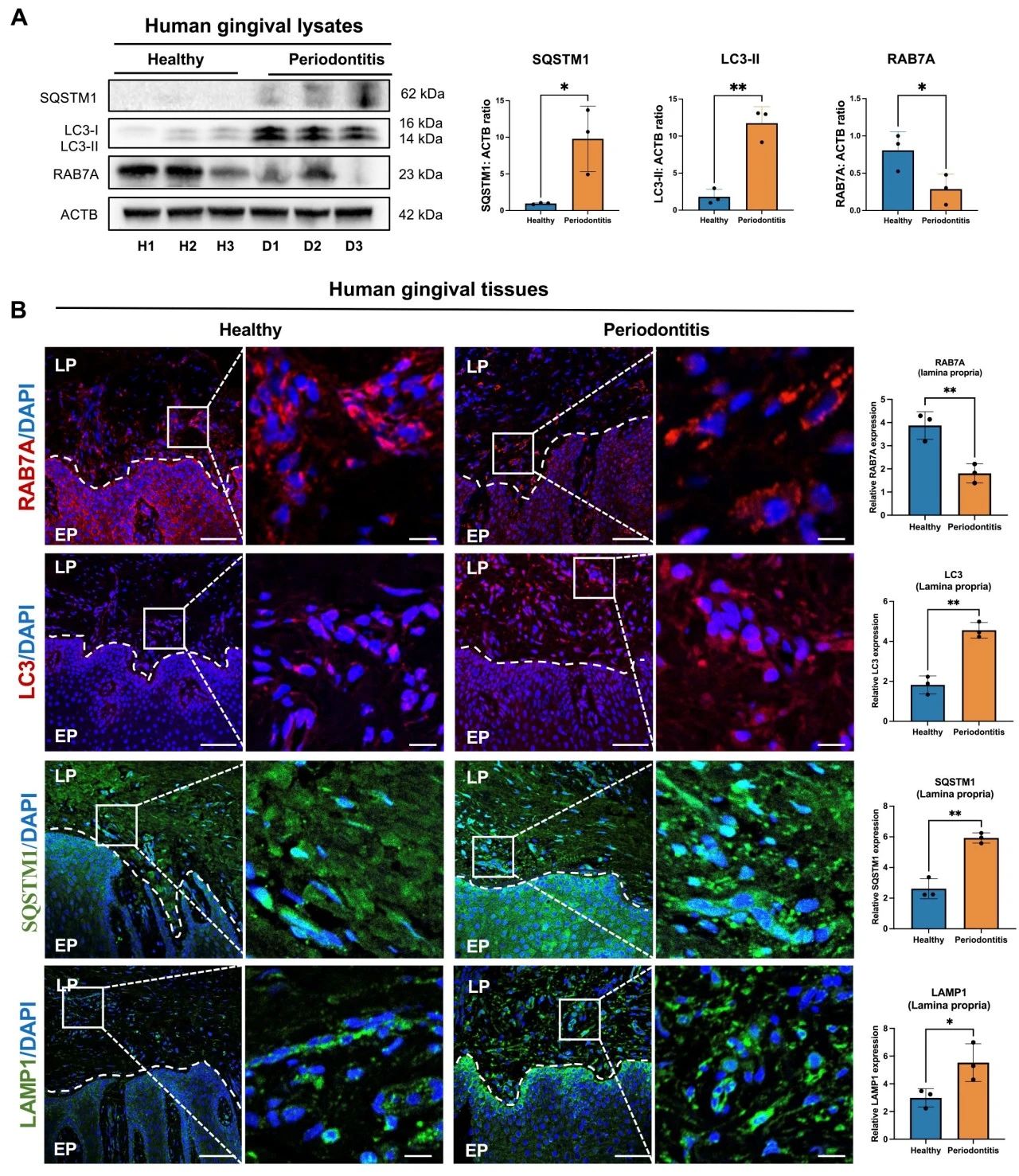 Autophagy丨浙江大学研究团队揭示牙周炎发病新机制