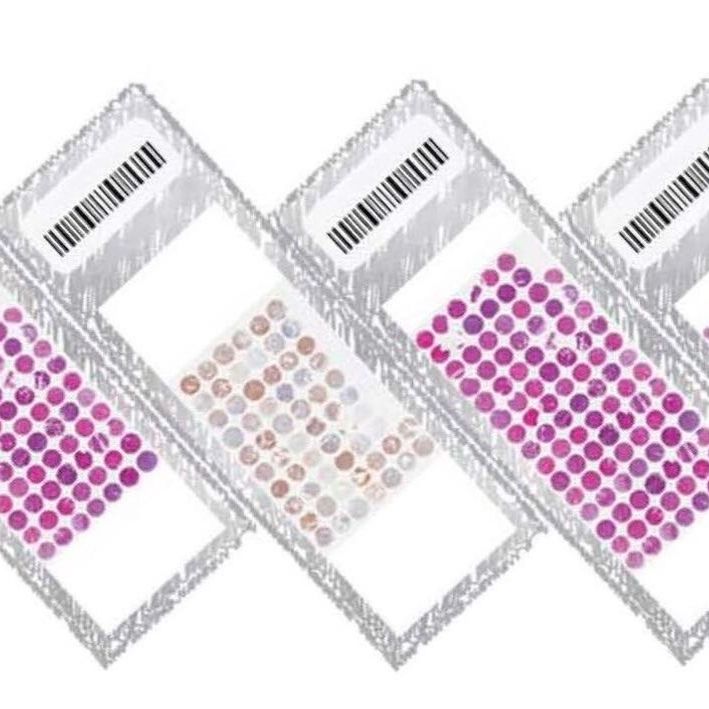 生存期膀胱癌组织芯片