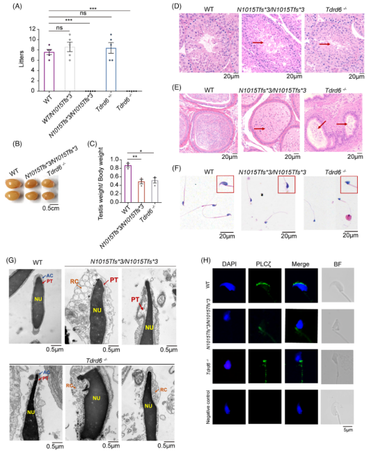 MedComm（IF=10.7）：全球首例TDRD6基因变异男性不育获成功治愈