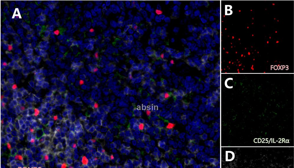 爱必信自用抗体大解密