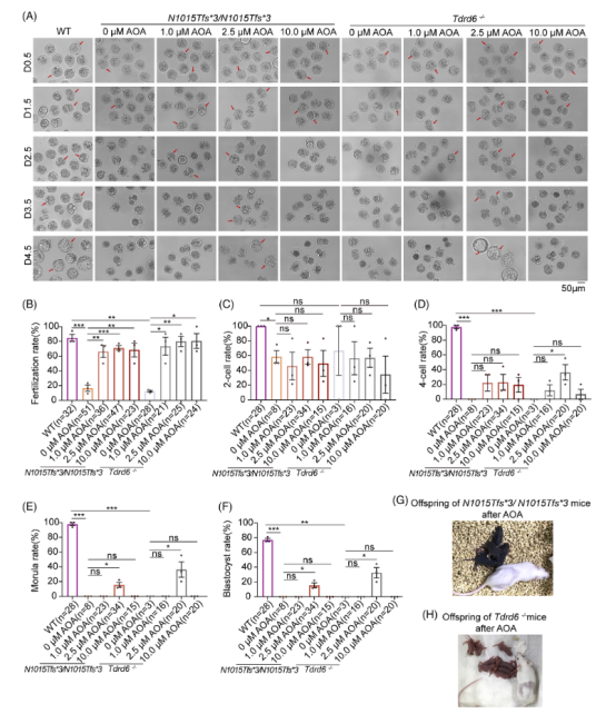 MedComm（IF=10.7）：全球首例TDRD6基因变异男性不育获成功治愈