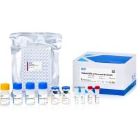Human IFN-γ Precoated ELISA Kit