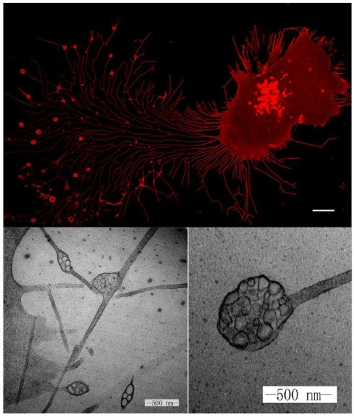 【2025年第1期】——迁移体研究全盘点，追踪科研新趋势