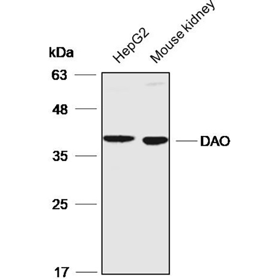 过氧化物酶体标志物