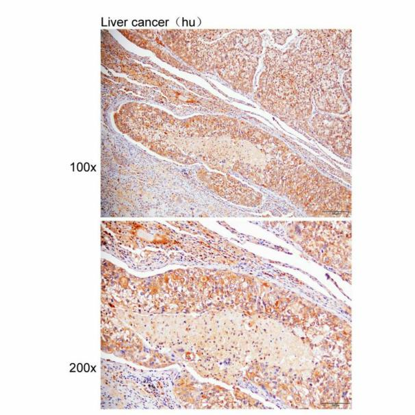 过氧化物酶体标志物