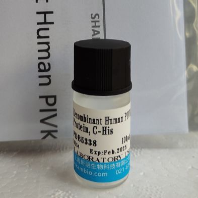 Adropin蛋白(AD)重组蛋白,小鼠