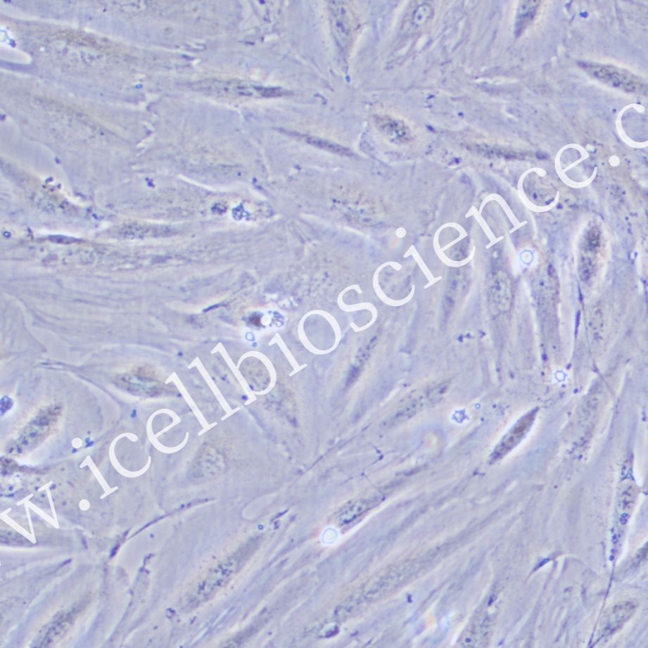 JHH-2 人肝癌细胞/JHH-2细胞/JHH-2/JHH2细胞/JHH2/STR鉴定/镜像绮点