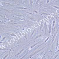 JHH-2 人肝癌细胞/JHH-2细胞/JHH-2/JHH2细胞/JHH2/STR鉴定/镜像绮点