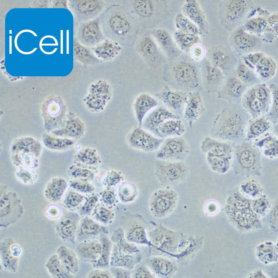 SW-13 人肾上腺皮质癌细胞/SW-13细胞/SW-13/SW13细胞/SW13/STR鉴定/镜像绮点（Cellverse）