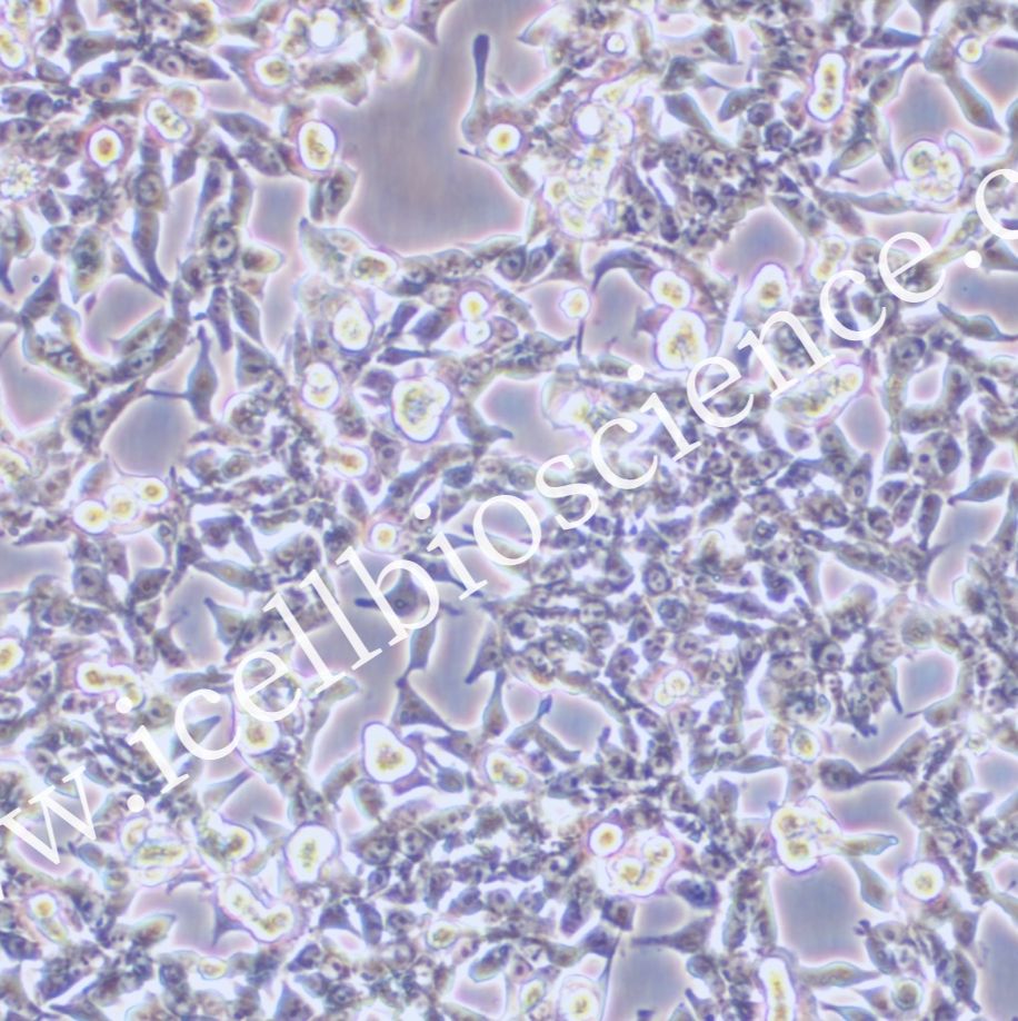 GP2D 人结肠癌细胞/GP2D/GP2D细胞/GP-2D细胞/GP-2D/STR鉴定