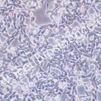 GP2D 人结肠癌细胞/GP2D/GP2D细胞/GP-2D细胞/GP-2D/STR鉴定