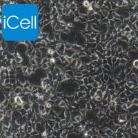 Hkb20 人肾上皮细胞/Hkb20细胞/Hkb20/Hkb-20细胞/Hkb-20/STR鉴定/镜像绮点(Cellverse)