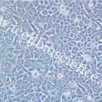 KU-19-19 人膀胱移行细胞癌细胞/KU-19-19细胞/KU-19-19/KU1919细胞