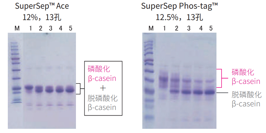 限时大促!SuperSep™ Phos-tag™预制胶多重福利来袭!