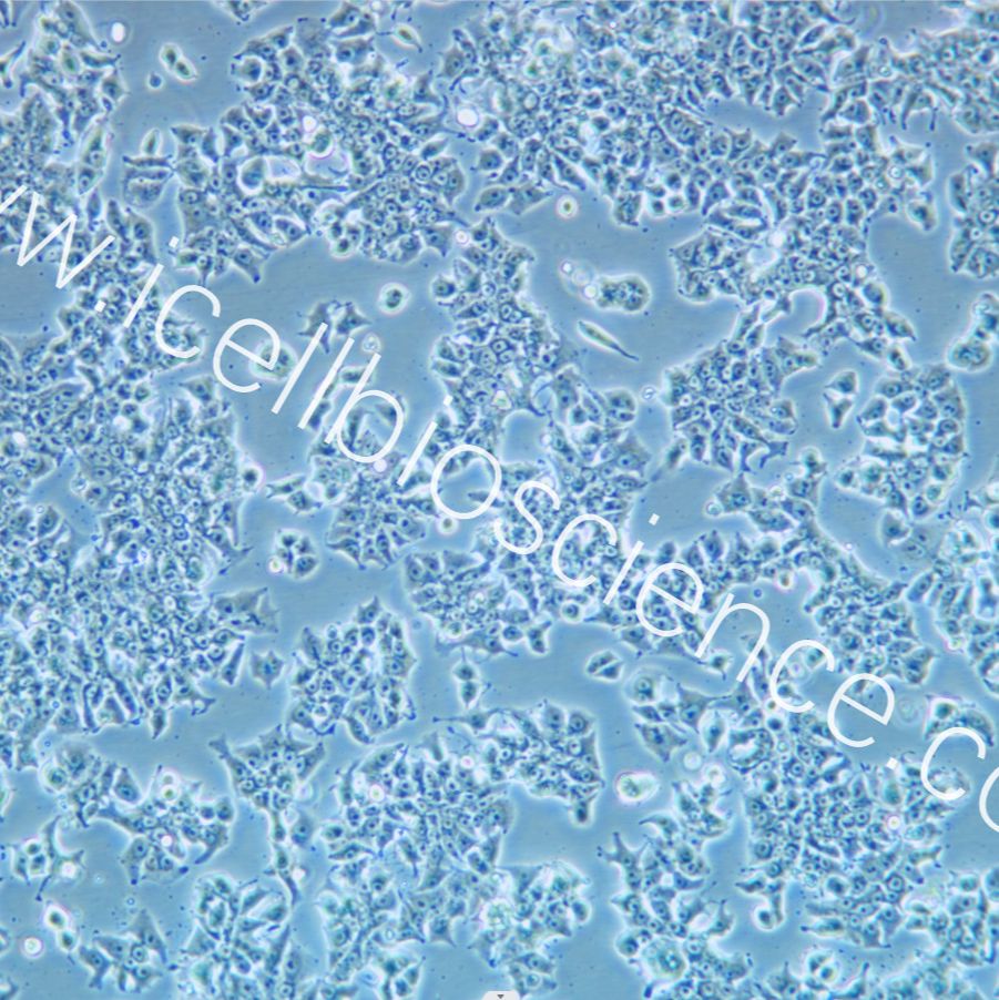 DMS 53 人肺癌细胞/DMS 53细胞/DMS 53/DMS53/DMS53细胞/STR鉴定/镜像绮点(Cellverse)