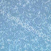 DMS 53 人肺癌细胞/DMS 53细胞/DMS 53/DMS53/DMS53细胞/STR鉴定/镜像绮点(Cellverse)