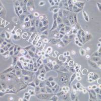 MKN-74 | 人胃癌细胞 | MKN-74 | MKN-74细胞 | MKN74细胞