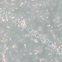 RT112 人膀胱癌细胞/RT112细胞/RT112/RT-112细胞/RT-112/STR鉴定/镜像绮点(Cellverse)