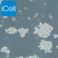 NCI-H82 人小细胞肺癌细胞/NCI-H82细胞/NCI-H82/NCIH82细胞/NCIH82/STR鉴定