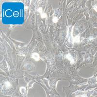 WPMY-1 人正常前列腺基质永生化细胞/WPMY-1细胞/WPMY-1/WPMY1细胞/WPMY1/STR鉴定/镜像绮点（Cellverse）