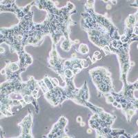 SNU719 人胃癌细胞/SNU-719/SNU-719细胞/SNU719细胞/SNU719/STR鉴定/镜像绮点(Cellverse)