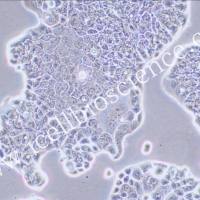 BT483 人乳腺导管癌细胞/BT483/BT483细胞/BT-483细胞/BT-483/STR鉴定