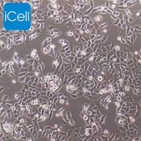 BT-B 人宫颈癌细胞/BT-B/BT-B细胞/BTB细胞/BTB/STR鉴定/镜像绮点