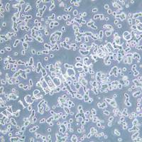 SW403 人结肠腺癌细胞/SW-403细胞/SW-403/SW403细胞/SW403/STR鉴定/镜像绮点(Cellverse)