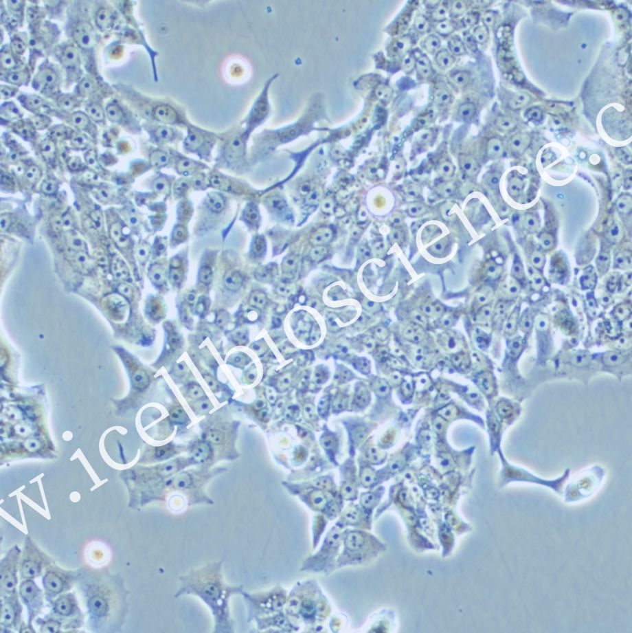 SW837 人结肠直肠腺癌细胞/SW837/SW837细胞/SW-837/SW-837细胞/STR鉴定/镜像绮点(Cellverse)