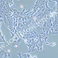 SW837 人结肠直肠腺癌细胞/SW837/SW837细胞/SW-837/SW-837细胞/STR鉴定/镜像绮点（Cellverse）