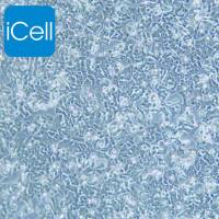 BIU-87 人膀胱癌细胞/BIU-87细胞/BIU-87/BIU87细胞/BIU87/STR鉴定细胞株/ATCC细胞系