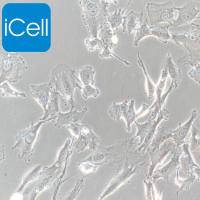 SW579 | 人甲状腺癌细胞 | SW-579 | SW-579细胞 | SW579细胞 | SW579 | STR鉴定