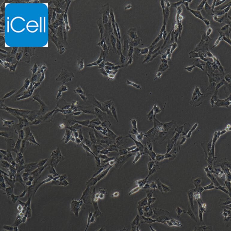 SW982 人滑膜肉瘤细胞/SW982/SW982细胞/SW-982细胞/SW-982/STR鉴定/镜像绮点（Cellverse）