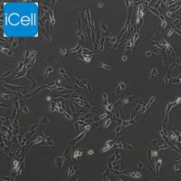 SW982 人滑膜肉瘤细胞/SW982/SW982细胞/SW-982细胞/SW-982/STR鉴定/镜像绮点(Cellverse)