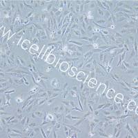 TCCSUP、TCCSUP细胞、TCCSUP细胞、TCCSUP人膀胱癌细胞/STR鉴定