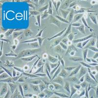 EJ （EJ-1）人膀胱癌细胞 | EJ细胞 | EJ1细胞 | EJ-1 | EJ1 | STR