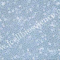 G-401细胞 | G401细胞| G401 |G-401 | 人肾癌Wilms细胞 | STR鉴定 | 镜像绮点(Cellverse)