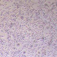 KYSE-520人食管鳞癌细胞_KYSE-520细胞(STR鉴定报告)