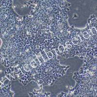 NCI-H2227 | NCI-H2227细胞 | 人小细胞肺癌细胞 | STR鉴定