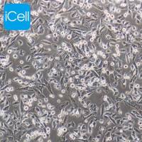 NCI-H1703/NCI-H1703细胞/人肺鳞癌细胞/STR鉴定