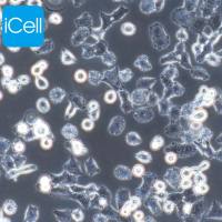 NCI-H157/NCI-H157细胞/人非小细胞肺腺癌细胞/STR鉴定