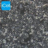 PANC-1/PANC-1细胞/PANC1细胞/PANC1/人胰腺癌细胞/STR鉴定