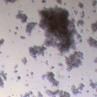 NCI-H146人小细胞肺癌细胞_NCI-H146细胞(STR鉴定报告)