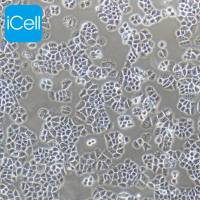 NCI-H460/NCI-H460细胞/人大细胞肺癌细胞/STR鉴定/镜像绮点（Cellverse）