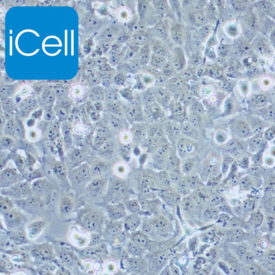 Nthy-ori 3-1细胞 | Nthyori 3-1细胞 | Nthyori 31细胞 |人甲状腺正常细胞 | STR鉴定 | 镜像绮点（Cellverse）