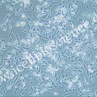 PSN-1/PSN-1细胞/PSN1细胞/PSN1/人胰腺癌细胞/STR鉴定/镜像绮点生物