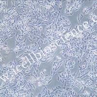 92-1/92-1细胞/921细胞/921/人眼葡萄膜黑色素瘤/镜像绮点（Cellverse）