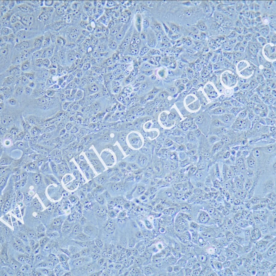 NCI-H441/NCI-H441细胞/人肺腺癌细胞/STR鉴定/镜像绮点(Cellverse)