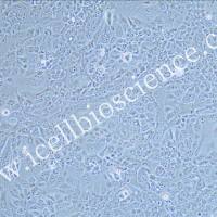 NCI-H441/NCI-H441细胞/人肺腺癌细胞/STR鉴定/镜像绮点（Cellverse）